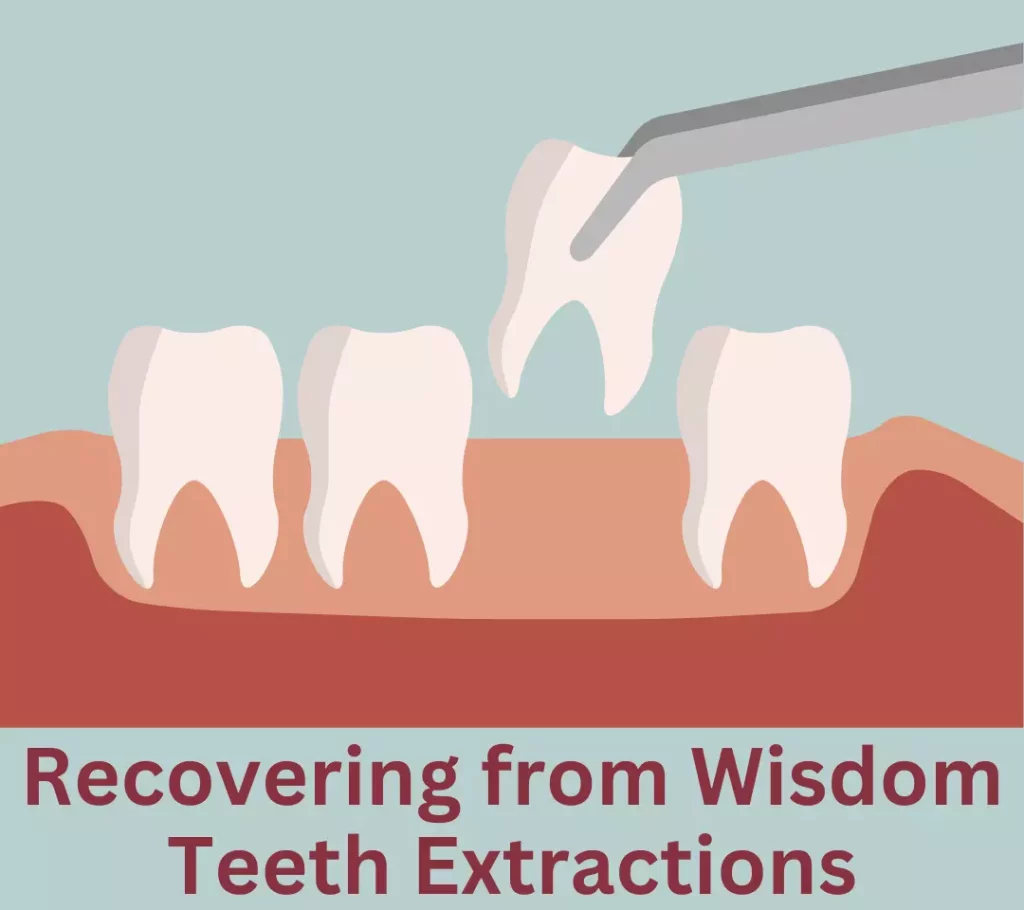 Tips for Recovering from Wisdom Teeth Extractions