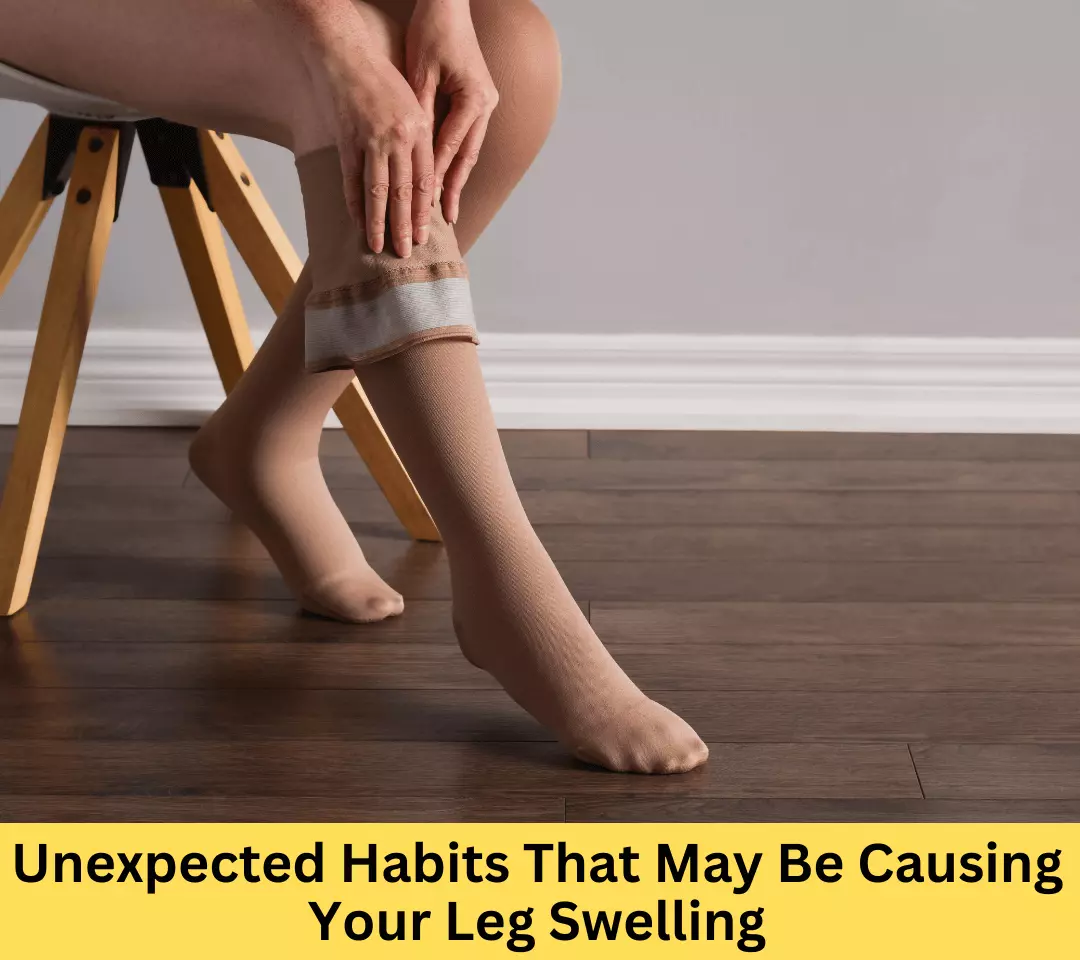 5 Unexpected Habits That May Be Causing Your Leg Swelling